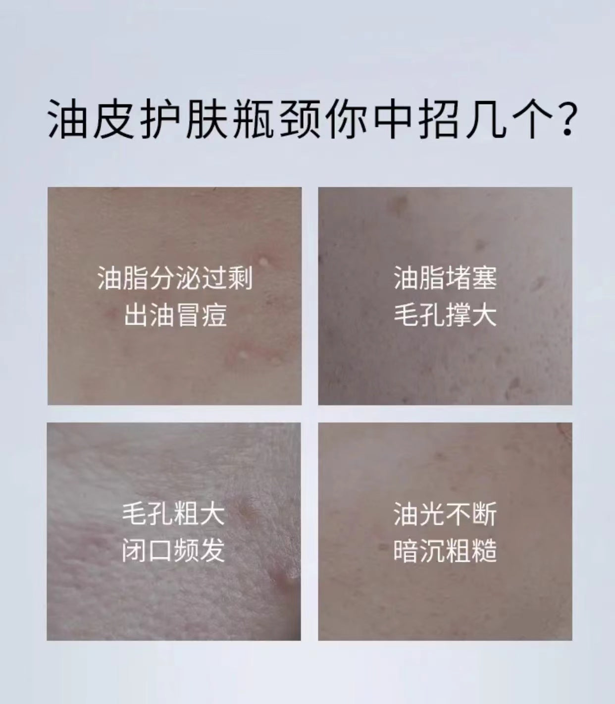 Tiktok/Douyin Hot CORRECTORS Pore Softening Conditioning Essence 18ml【Tiktok抖音爆款】 科瑞肤毛孔柔护调理精华液