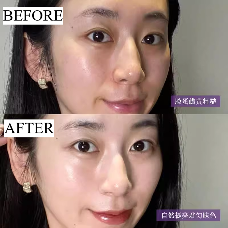 Tiktok/Douyin Hot De medicotem Illuminating White Cell Ampoule【Tiktok抖音爆款】韩国德魅蔻素颜滴精华液