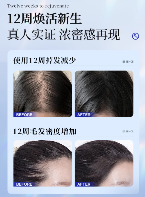 EHD Anti-Hair Loss Strengthening Serum 60ml EHD防脱固发精华液