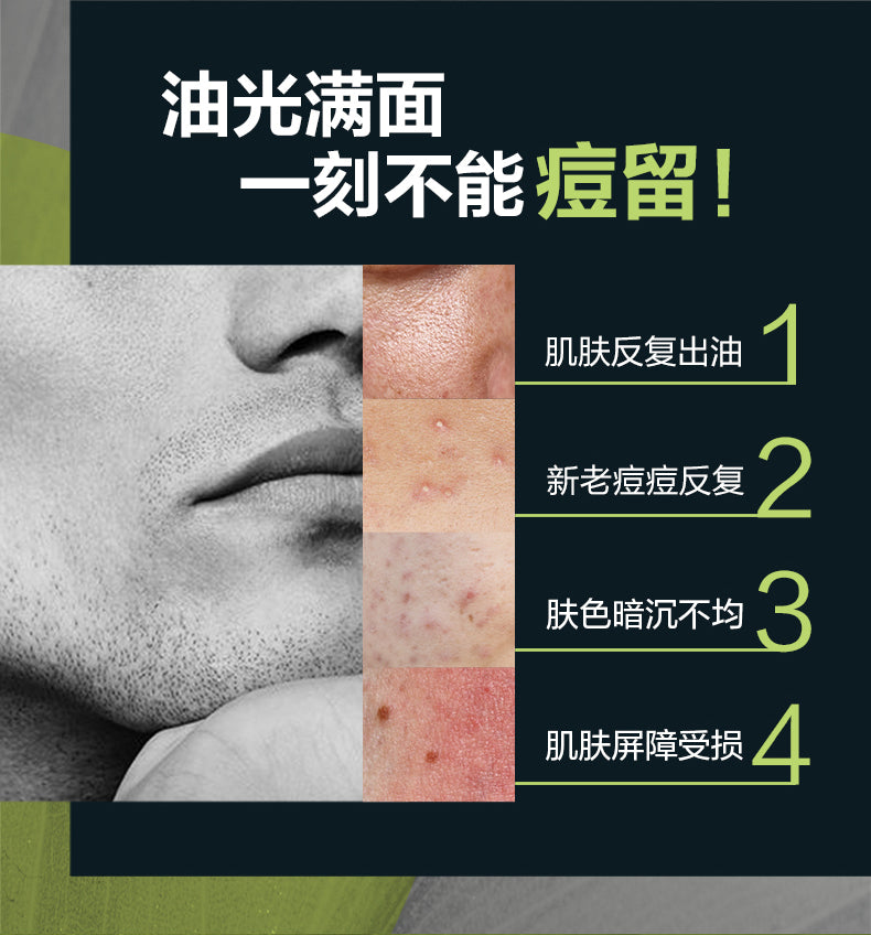 Mentholatum Oil Control & Anti-Acne Facial Cleanser For Men 150ml 曼秀雷敦控油抗痘男士洁面乳