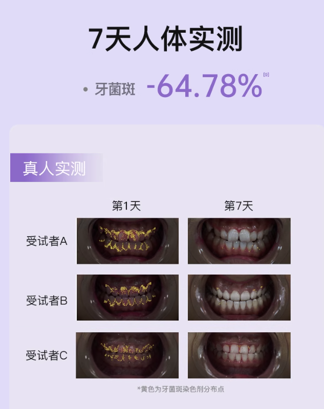 Saky GT-2 Orbital Sonic Electric Toothbrush 舒客GT-2星环声波电动牙刷